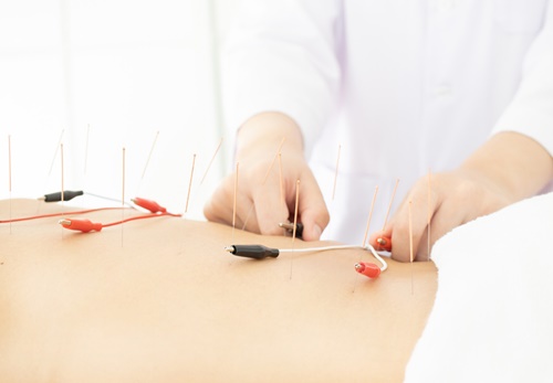 traitement naturel contre l'acné - électro acupuncture